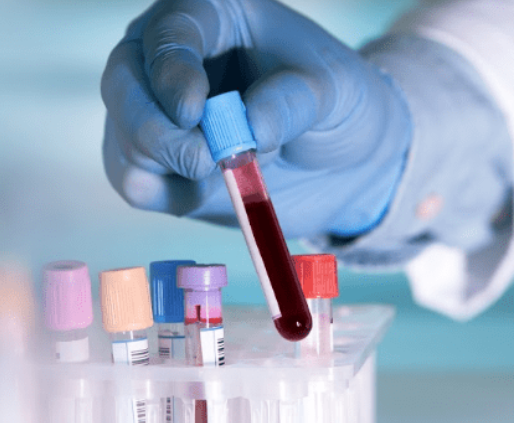 Especialista sosteniendo un tubo de ensayo lleno de sangre